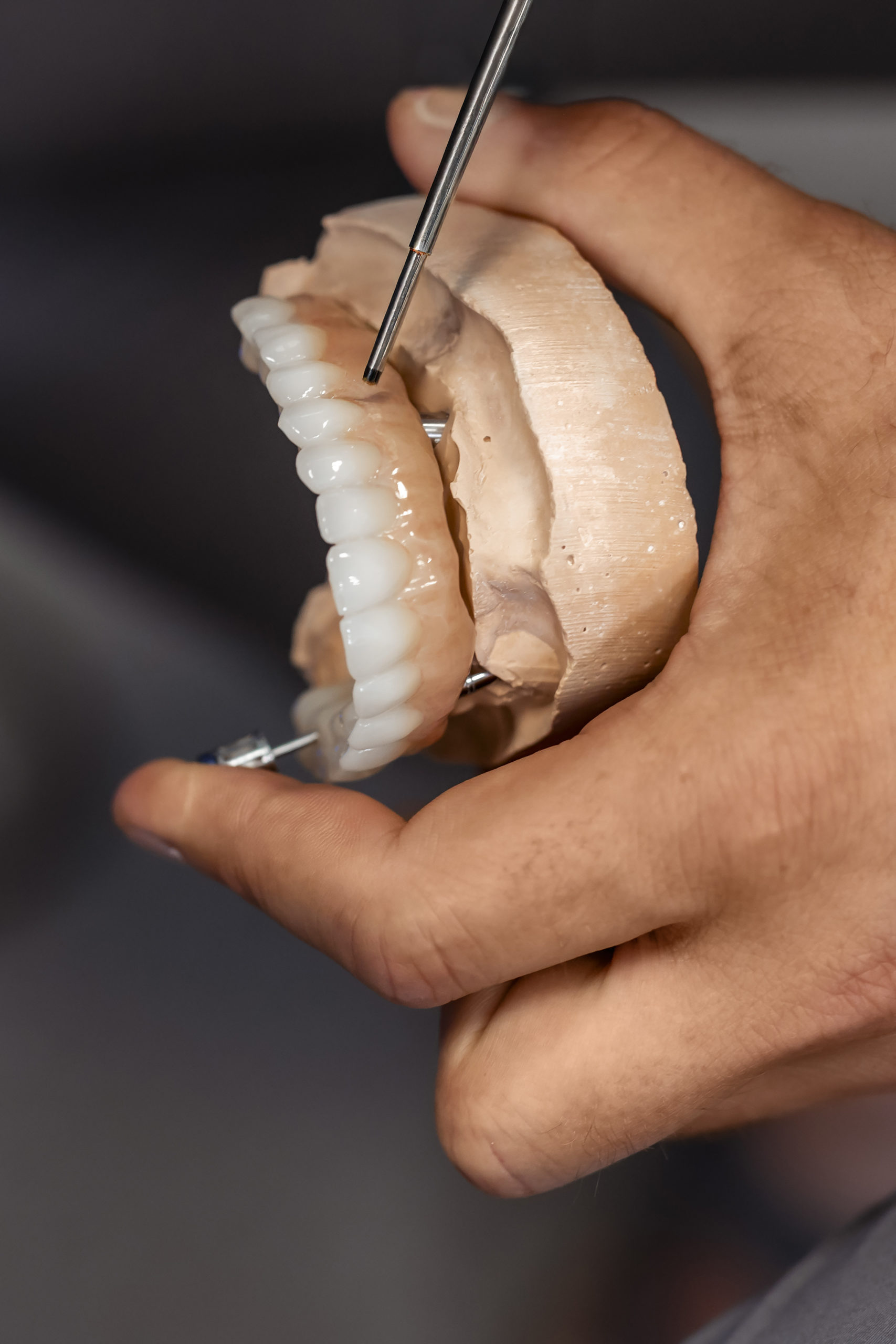 Protezy na implantach