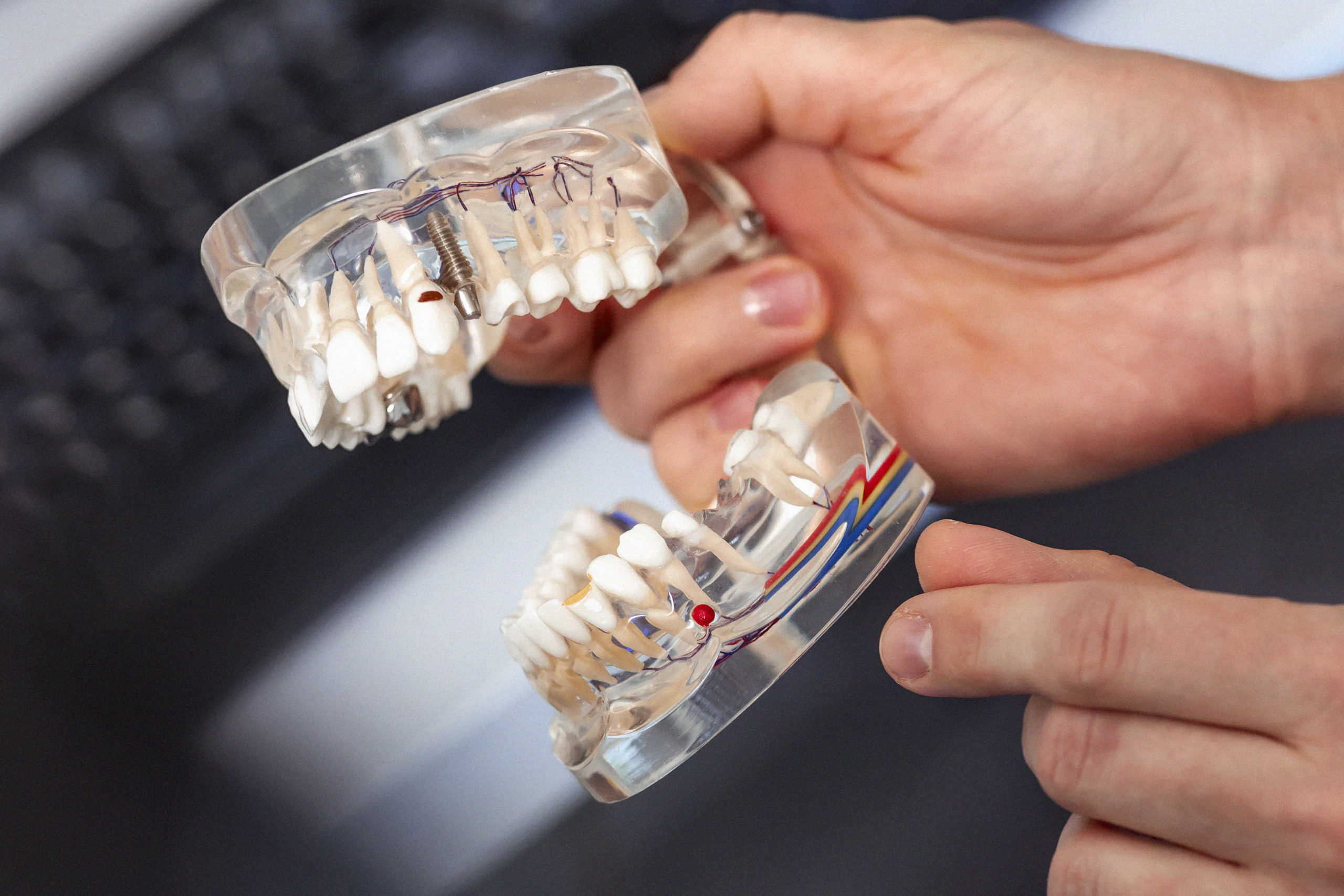 Leczenie zębów pod&nbsp;mikroskopem Ruda Śląska